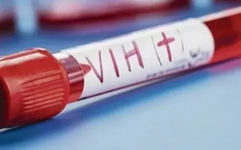 Los testeos de VIH son gratuitos en Argentina