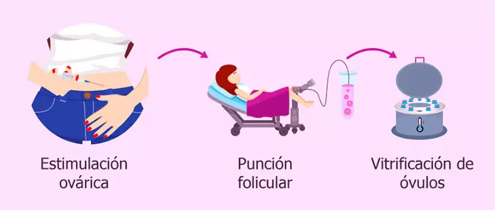 Proceso de congelamiento de vulos