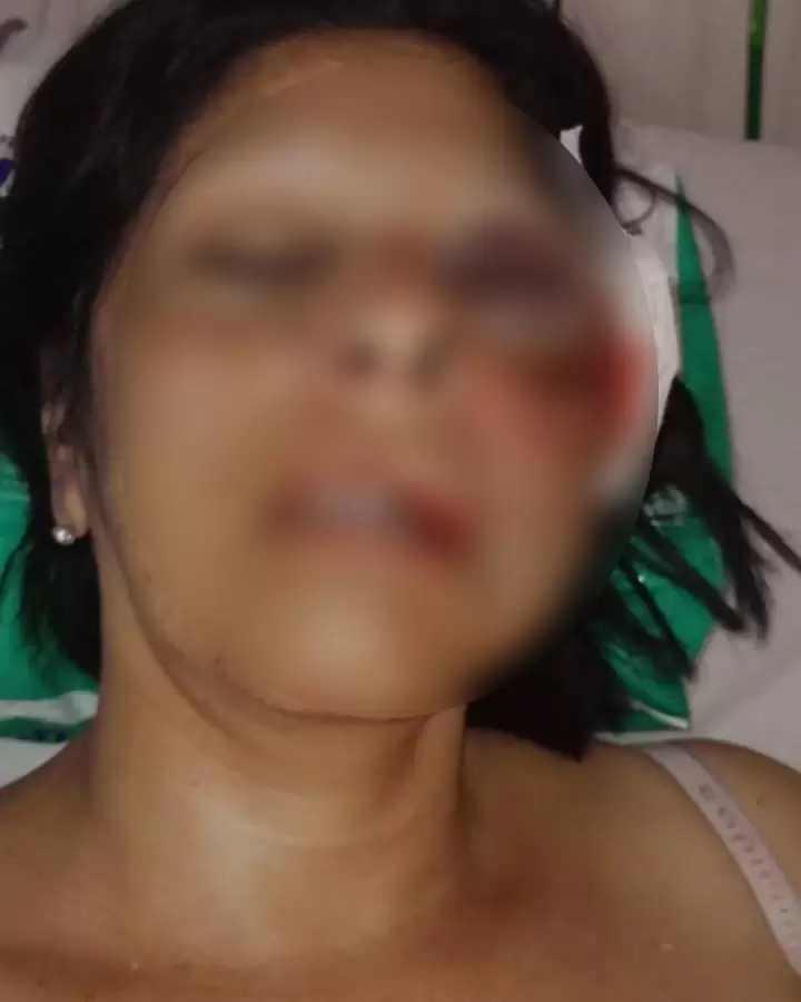 La mujer fue brutalmente atacada en su casa de Laferrere