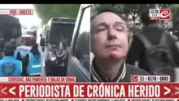 Diego Ricciardi, periodista de Crnica TV herido de bala