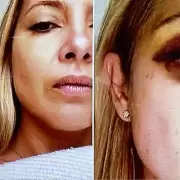 "Vens golpendome hace 3 das seguidos": las fotos de Fabiola Yez golpeada y las excusas de Alberto