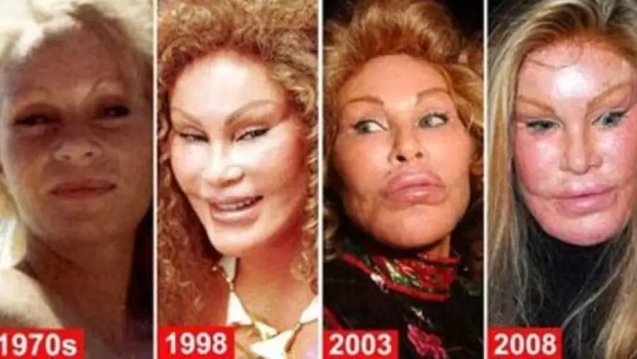 El sorpresivo antes y despus de Jocelyn Wildenstein