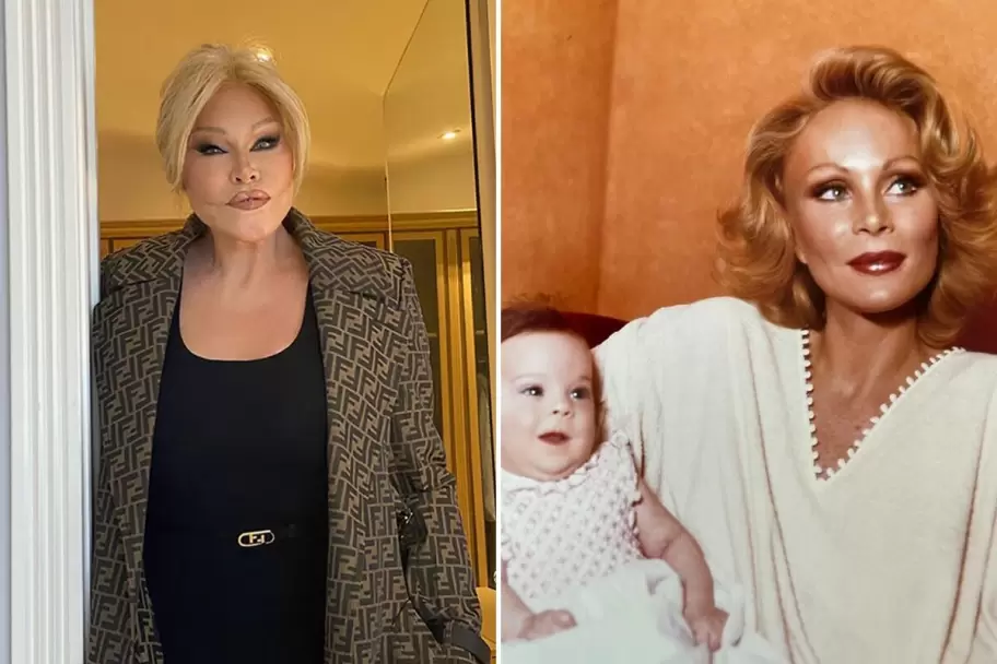 As fue el cambio de Jocelyn Wildenstein, que se oper para parecerse a un felino