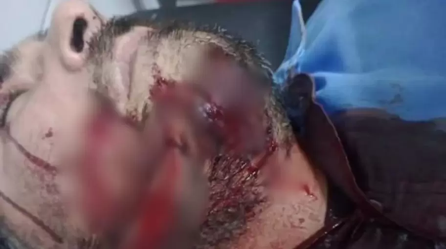 Brutal ataque a un colectivero en La Matanza