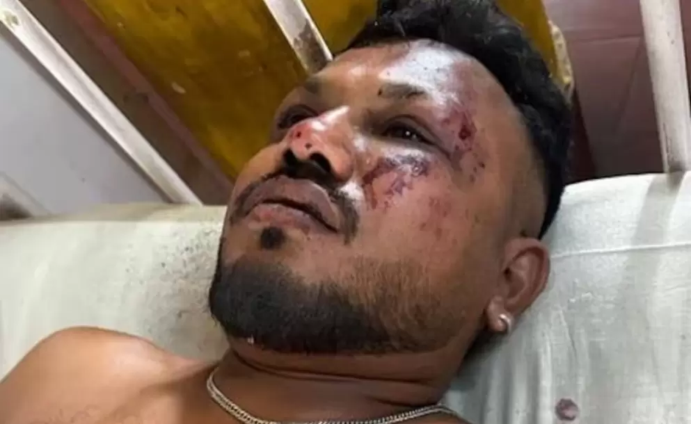 "Tenía miedo y corrí": quién es el único sobreviviente del brutal accidente aéreo del vuelo AI-171 en India