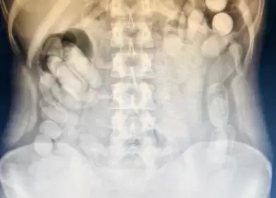 Detienen a una pasajera que había ingerido más de 100 cápsulas de cocaína