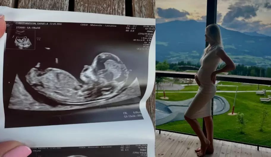 Daniela Christiansson mostr su panza y la ecografa de su segundo hijo