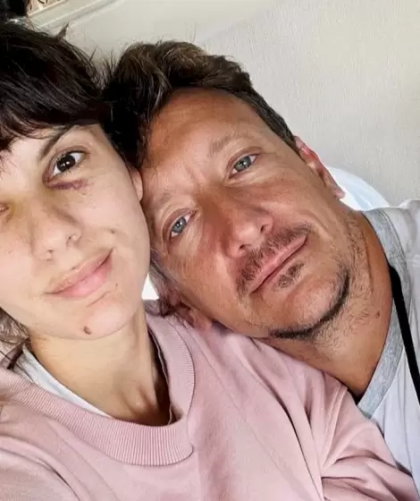 Nico Vázquez y Gimena Accardi confirmaron su separación tras 18 años juntos