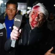 El da despus del periodista que recibi un botellazo en el acto de cierre de Milei: "Este impacto a un nene lo mata"