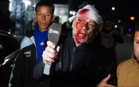 Cristian Mercatante tras la brutal agresin que recibi en Moreno.