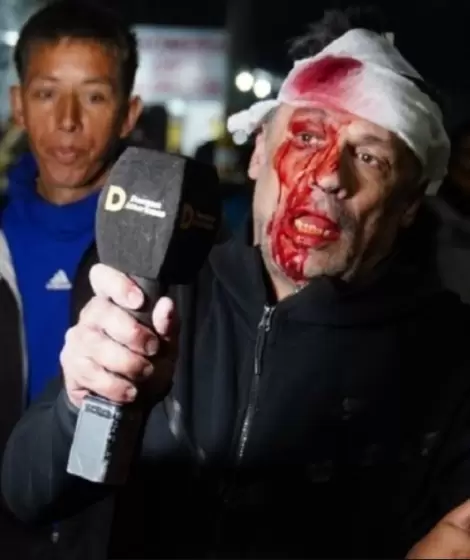 Cristian Mercatante tras la brutal agresin que recibi en Moreno.