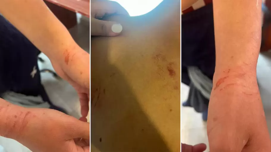 El horror que vivió Agustín en manos de sus empleadores