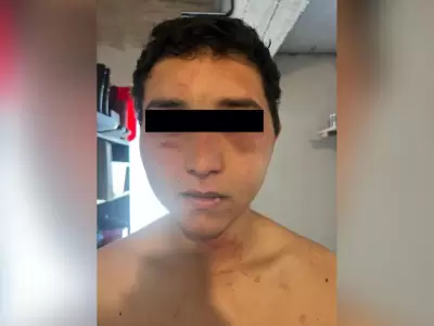 "Me sacó la oreja": el impactante testimonio del joven torturado en una estancia por sus jefes
