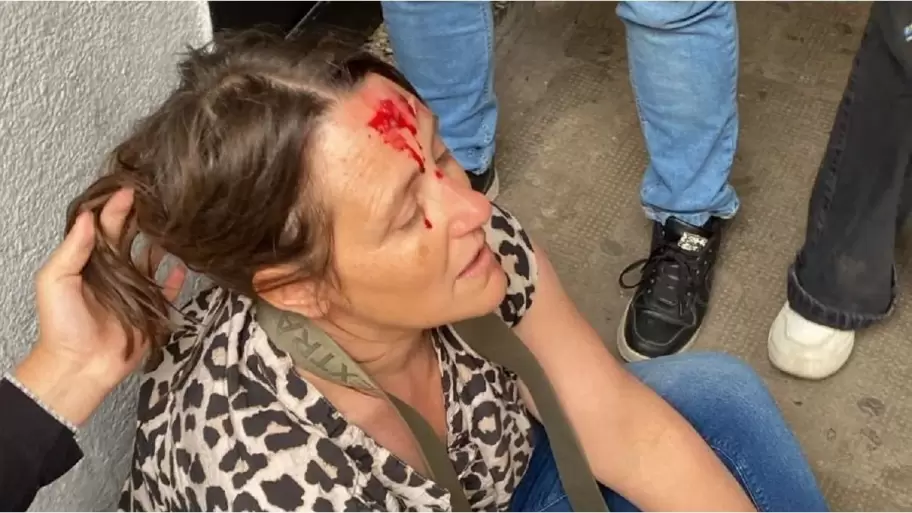 Violencia en el Normal 2 de La Plata: una pelea entre alumnos termin con una preceptora herida y denuncias de abandono institucional