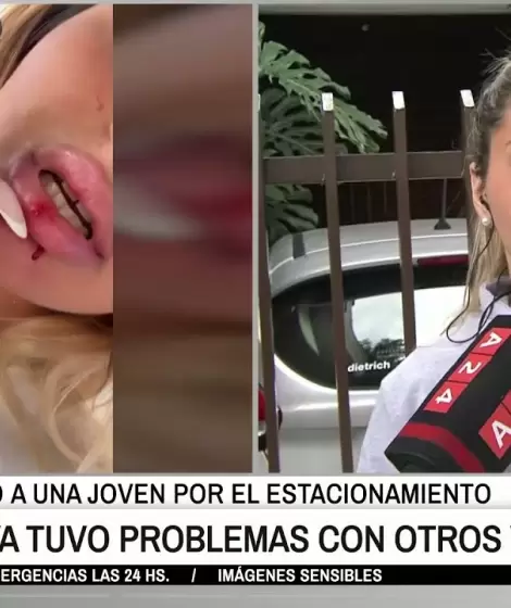 Seguridad Vial le suspendi la licencia a la joven que fue agredida por un jubilado