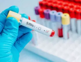 En 2025 hubo m�s de 46.000 casos