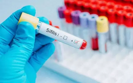 En 2025 hubo m�s de 46.000 casos