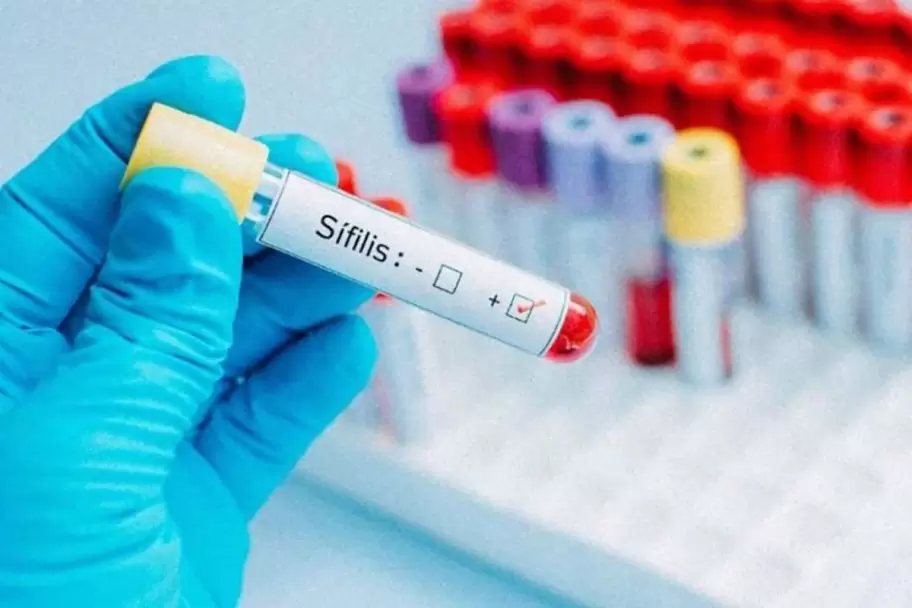 En 2025 hubo un aumento del 20,5% en los casos de sífilis