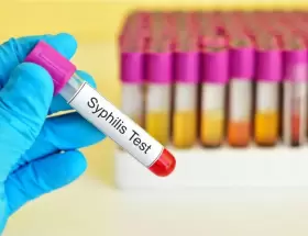 Aumentaron los casos de s�filis