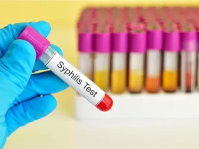 Aumentaron los casos de s�filis
