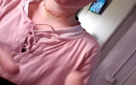 La menor con la herida en el cuello a�n cicatriz�ndose.