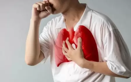 Alerta tuberculosis: se notificaron ms de 13.000 casos en Argentina