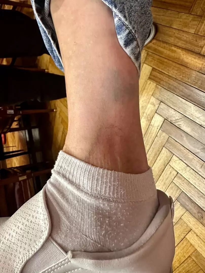 Manoseos, golpes y un cerrajero que terminó siendo testigo involuntario