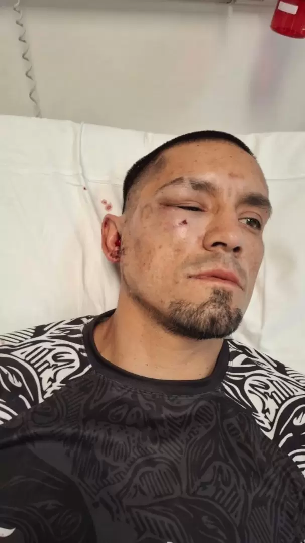 Un joven golpeó por la espalda a un profesor y le destrozó el rostro