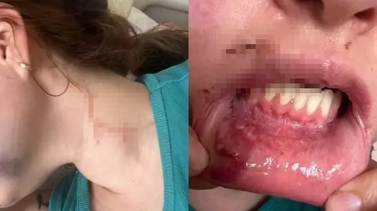 La mamá de Kiara Maqueira pudo salvarla de los ataques de su novio