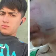 Intento de femicidio: buscan desesperadamente a Agustn Ramos que sigue prfugo tras un brutal ataque