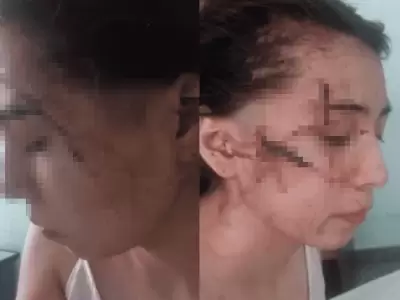 La v�ctima tras la agresi�n