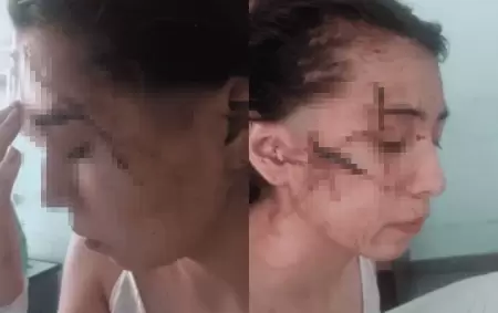 La v�ctima tras la agresi�n