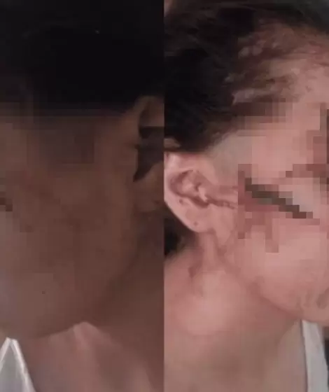 La v�ctima tras la agresi�n