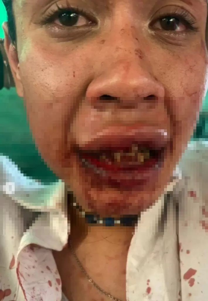 Brutal ataque a Verdún Mar Desire