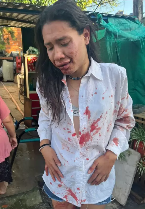 Verdún Mar Desire denunció que fue atacada por un grupo de personas