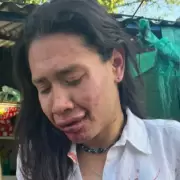 Brutal ataque transf�bico en Don Torcuato: "Sobreviv� para contarlo"