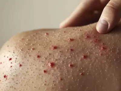 Alerta sanitaria: reaparece el sarampi�n