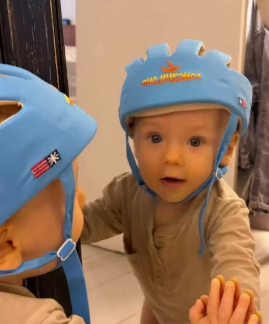 Muni Seligmann mostr� el casco protector que usa su beb� desde que se fractur� el cr�neo