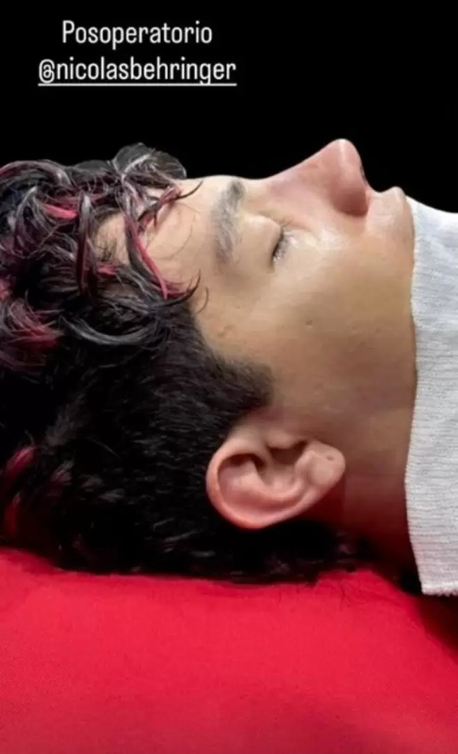 Nicol�s Behringer entre fama, cirug�a y mudanza