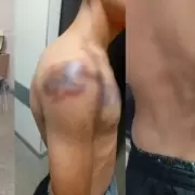 Cayó "Roly", el chaqueño que terminó quemado y detenido tras dejar sin agua a toda una ciudad