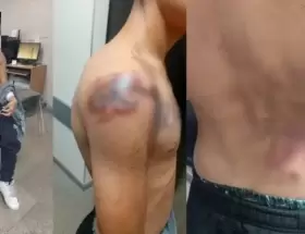 Roly, el joven que quiso robar en la Planta Potabilizadora N� 3 de Sameep