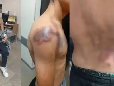 Roly, el joven que quiso robar en la Planta Potabilizadora N� 3 de Sameep