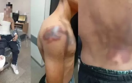 Roly, el joven que quiso robar en la Planta Potabilizadora N� 3 de Sameep