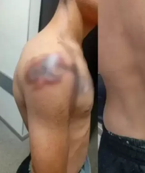 Roly, el joven que quiso robar en la Planta Potabilizadora N� 3 de Sameep