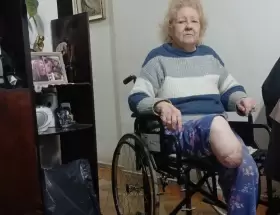 Juana Rosa Pereira necesita una pr�tesis y, como el Estado brilla por su ausencia, necesita de la ayuda de todos.