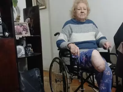 Juana Rosa Pereira necesita una pr�tesis y, como el Estado brilla por su ausencia, necesita de la ayuda de todos.
