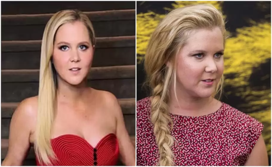Amy Schumer fue de las pocas que se animó a hablar de los efectos secundarios