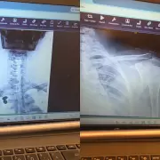 La operación contra Nadia Beller se cae a pedazos: publicó el informe psicológico y 10 fotos de sus heridas