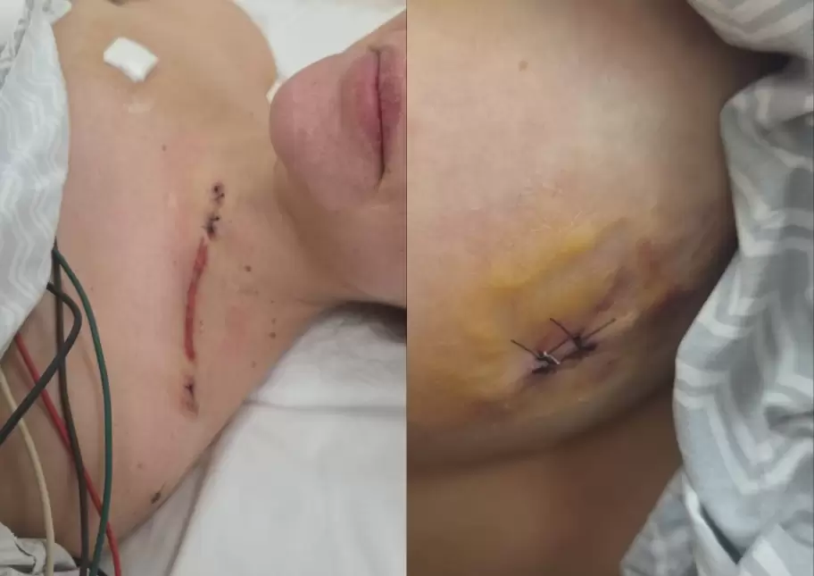 Las heridas que consignó Nadia Beller