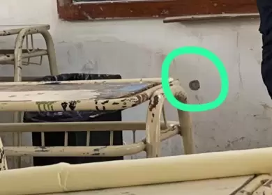 La foto del impacto de bala